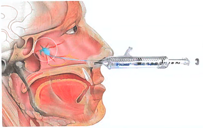 Head & Face Pain Elixir